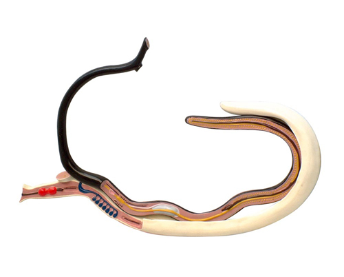 Ѫ���x(ch��ng)ģ�ͣ����ۺϱ���