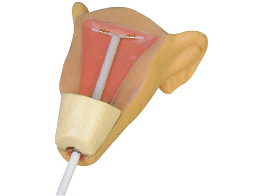 �߼��m��(n��i)������Ӗ(x��n)��ģ��