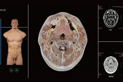 ���ӽ����c����Ӱ��̓�M�̌W(xu��)ϵ�y(t��ng)